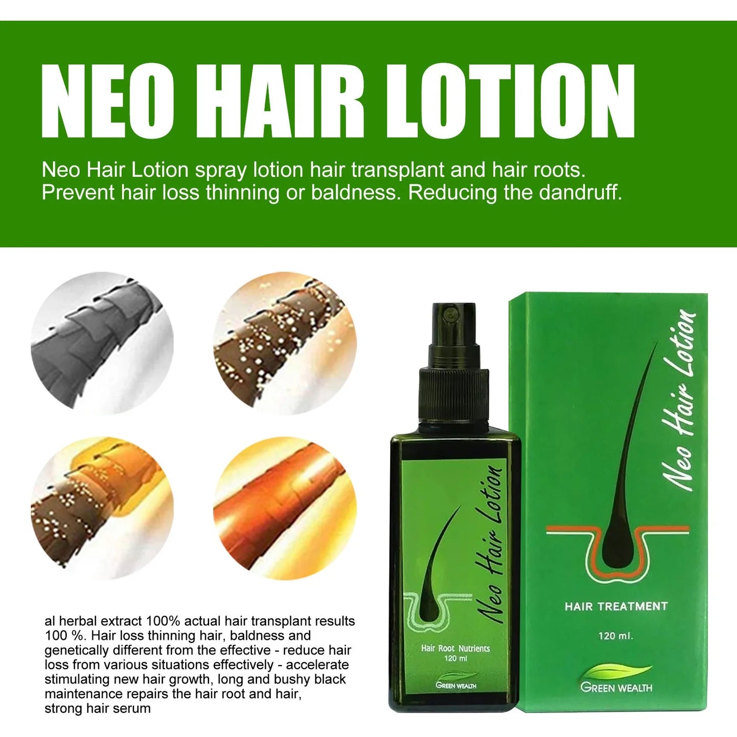 Hair Care Growth Lotion Spray